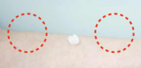 Du:pla (Skincare Device) medical-dermatology-plasticSurgery