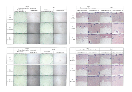 dusonic-clinical_studies