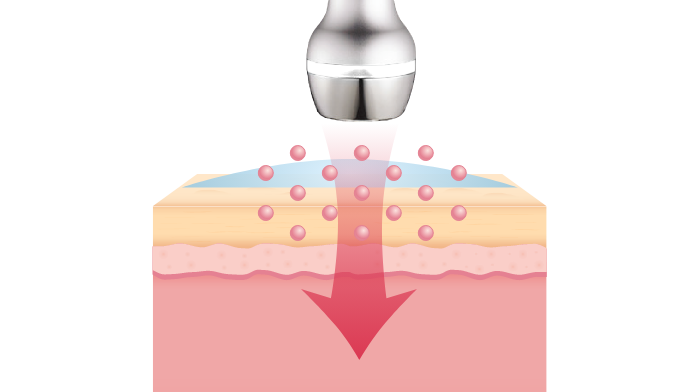 Este7 (Skincare Device) Skin moisture with sonophoresis