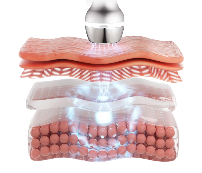 Este7 (Skincare Device) Ultrasound