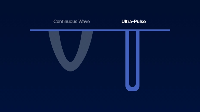 co2-surgical-laser-ultraPulse
