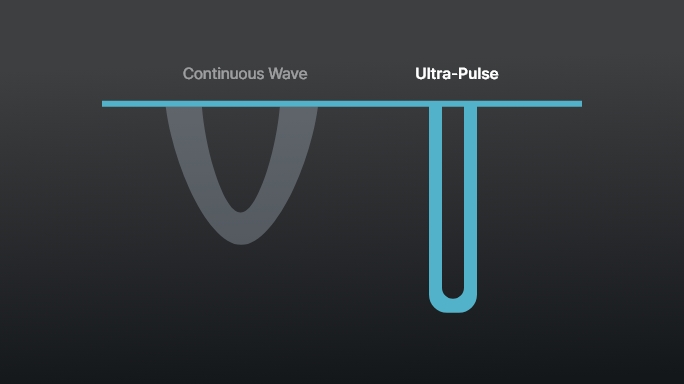 co2-surgical-laser-ultraPulse