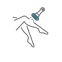 808 nm Diode Laser_Hair removal