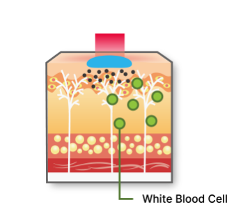 755, 808, 1064 nm Diode Laser_Skin Brightening