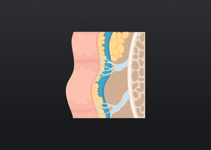 755, 808, 1064 nm Diode Laser