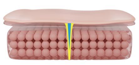 co2-surgical-fractional-laser