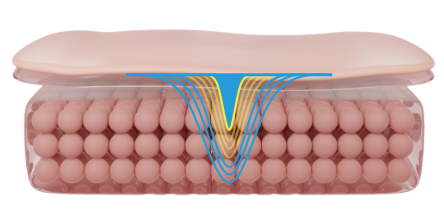 co2-surgical-fractional-laser
