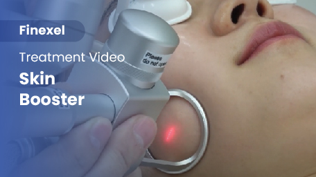 co2-surgical-fractional-laser-skinbooster