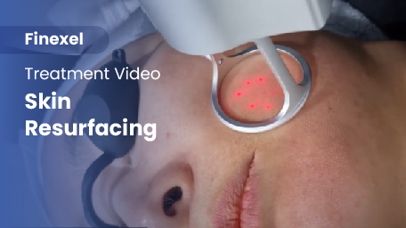 co2-surgical-fractional-laser-skinResurfacing