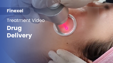 co2-surgical-fractional-laser-drugDelivery