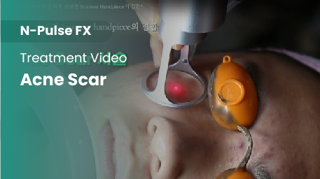 co2-surgical-fractional-laser-acne-scar