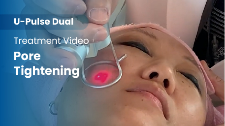 co2-surgical-fractional-laser-poreTightening