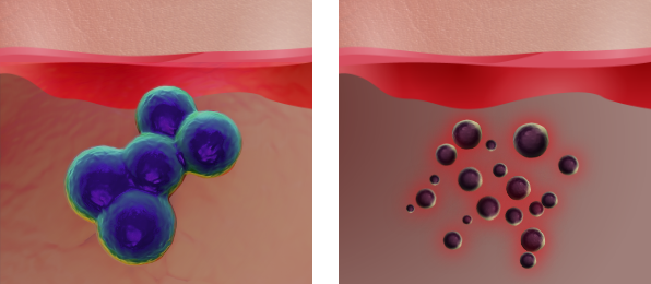 Q-Switched & Long-Pulsed Nd:YAG Laser_PDP mode